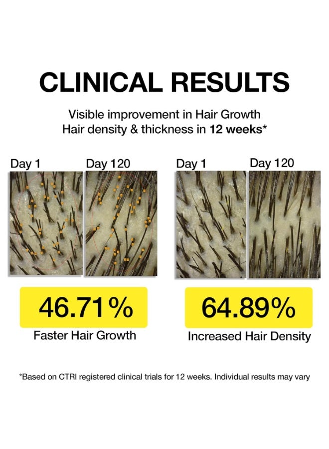 Soulflower Hair Growth Redensyl Tetragain Serum,Rosemary Oil,3% Redensyl,4% Anagain,Caffeine,Melanogray,Biotin,Rice Water,Anti Hair fall,Clinically Tested on Real people,Unisex|Pack of 3 30 ml each - Image 2